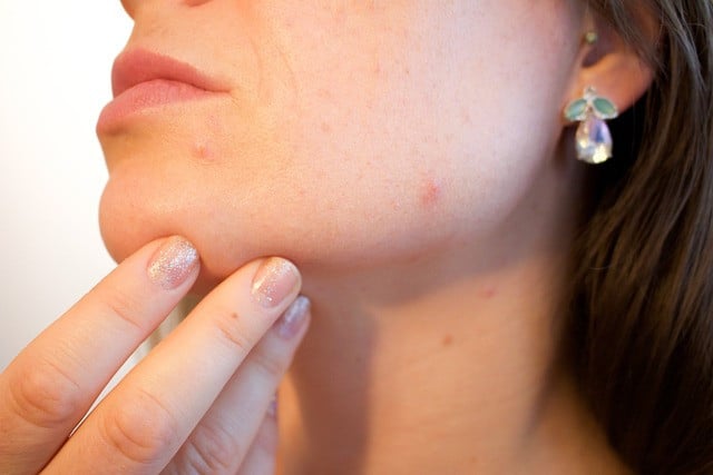 Skin rashes due to zinc deficiency